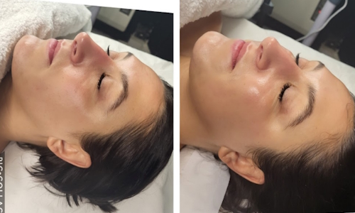 Classic Brightening Facial Facial Treatment Glasgow