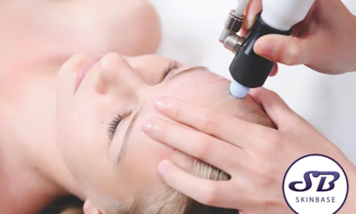 Microdermabrasion Facial Facial Treatment Glasgow