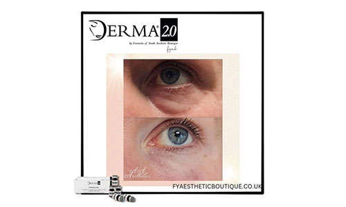 Derma 2 Eye Treatment Facial Treatment Glasgow