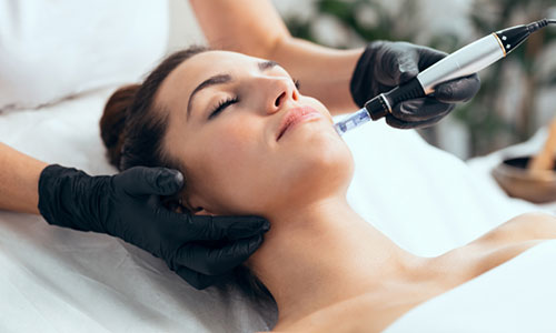 Microneedling Facial Treatment Glasgow