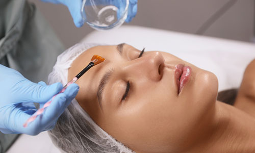 Refresh Chemical Peel Facial Treatment Glasgow