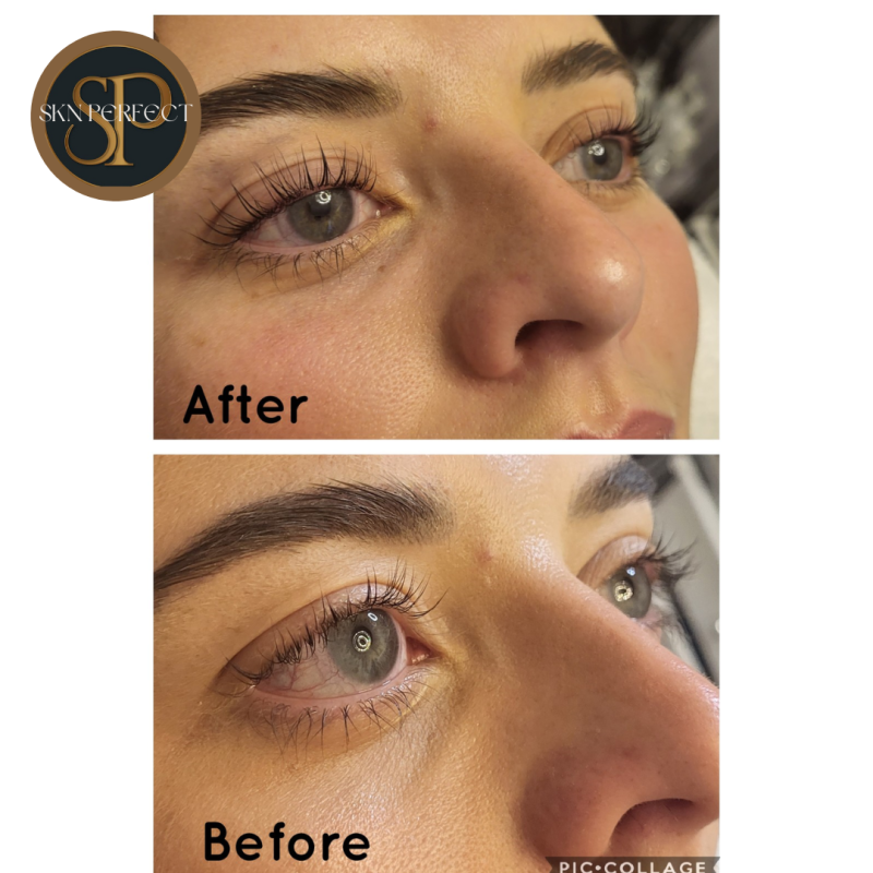 Lash Lift Treatments  Main Photo