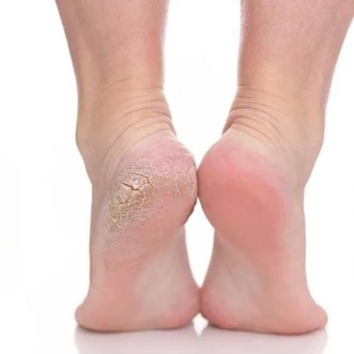 Footlogix Pediceutical Treatments Where MEDI meets PEDI.